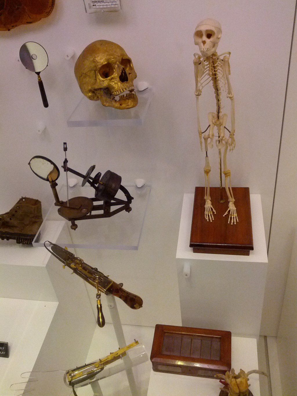 Exhibit in the National Museum of Health and Medicine